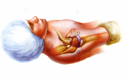 The position of the patient for shoulder arthroscopy and the access points or portals used